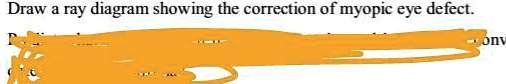 SOLVED: draw a ray diagram showing the correction of myopic eye defect ...