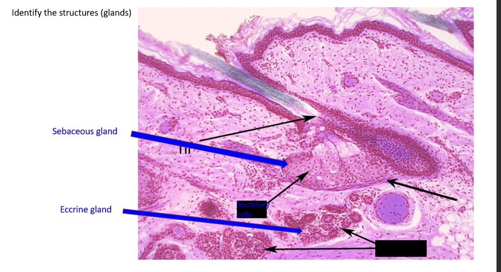 SOLVED: Identify the structures (glands) Identify the structures ...