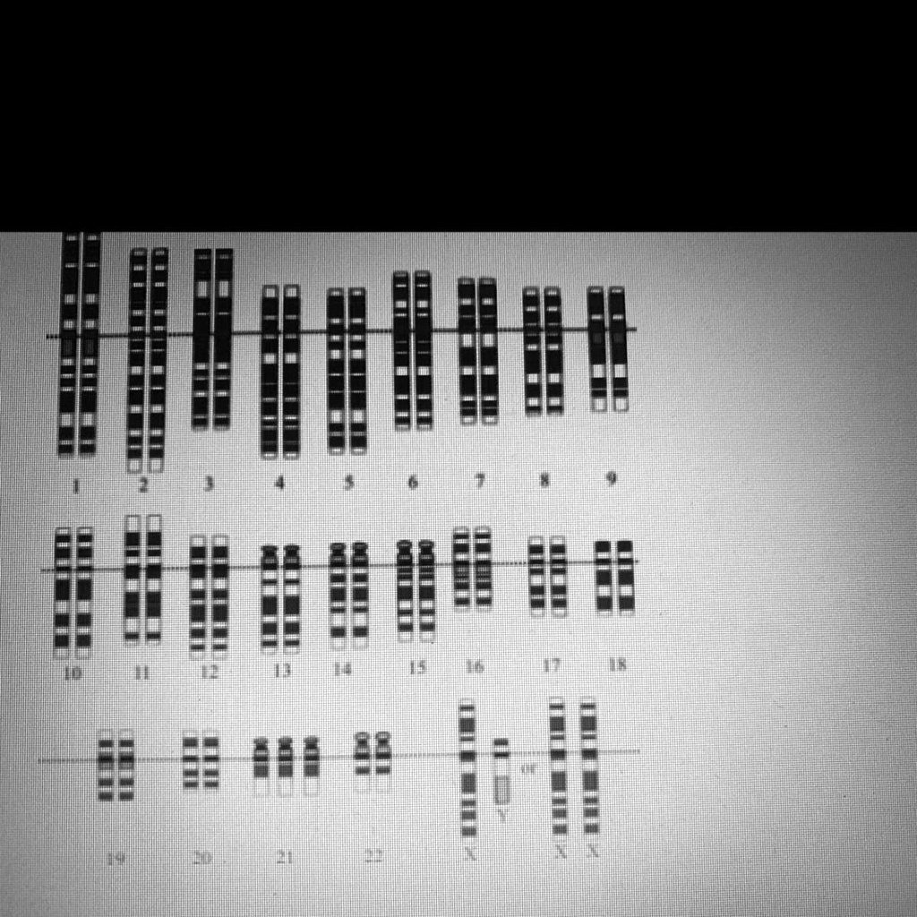 SOLVED: 'Use The Following Karyotype To Identify Any Genetic ...