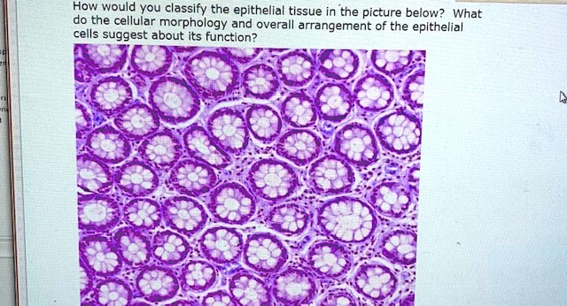 how-would-ou-classify-the-epithelial-tissue-in-the-pi-solvedlib