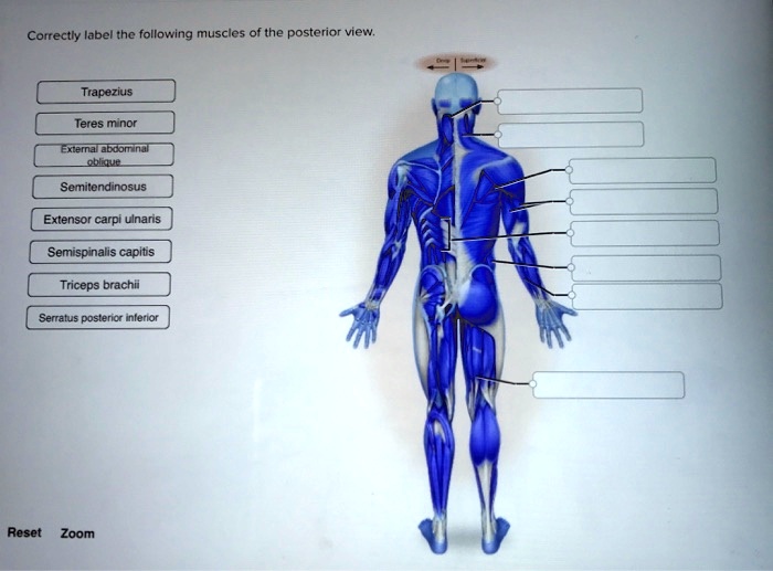 SOLVED Correctly label the following muscles of the posterior view