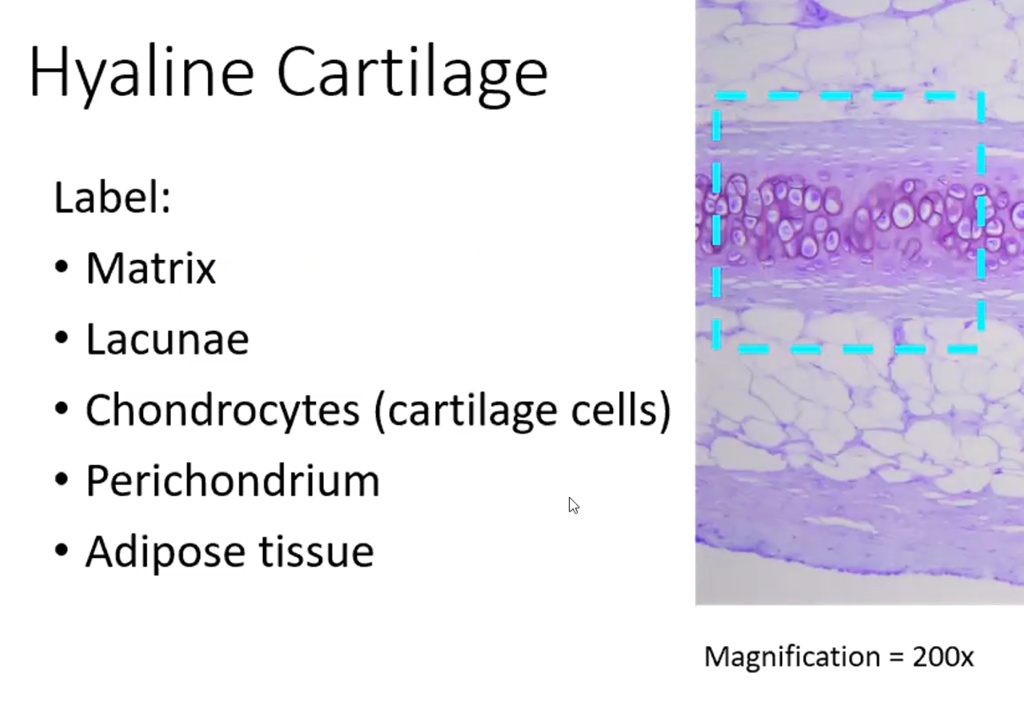 SOLVED: Hyaline Cartilage Label: Matrix Lacunae Chondrocytes (cartilage