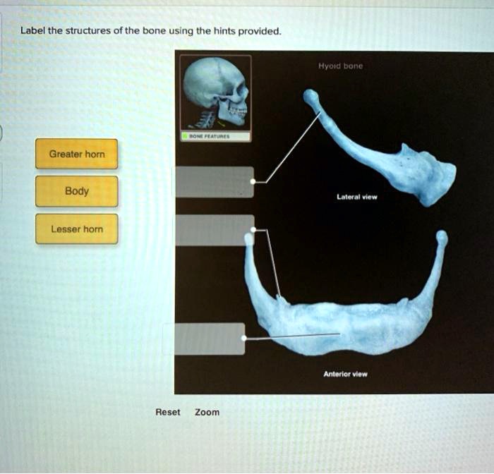 SOLVED Label the structures of the bone using the hints provided