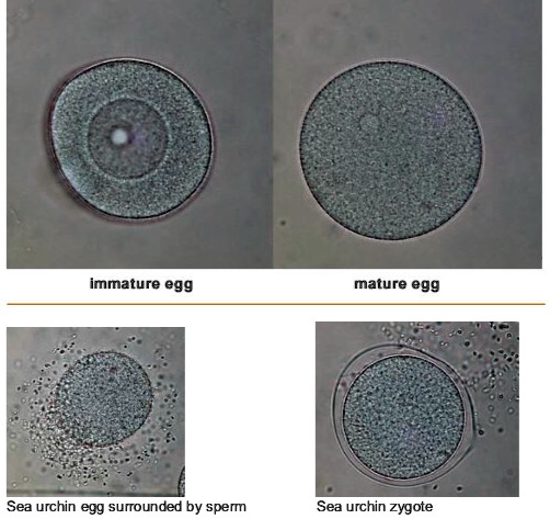 SOLVED: Sea Urchin Egg Label the parts of the sea urchin egg (vitelline ...