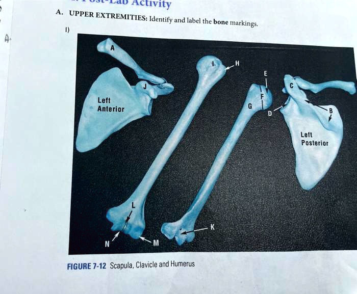 Scapula bone markings Diagram