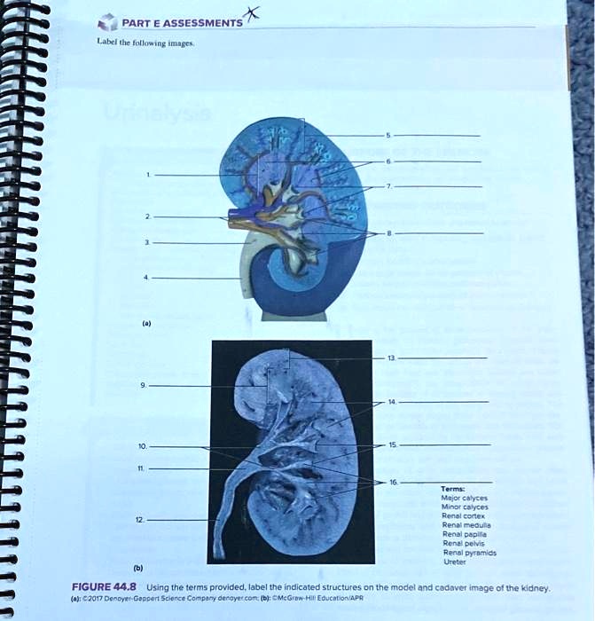 Solved Texts X Part Assessments Label The Following Images Terms Major Calyces Minor Calyces