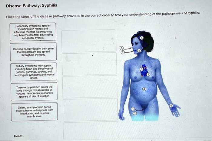 disease pathway syphilis place the steps of the disease pathway ...