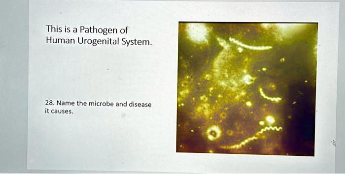 solved-this-is-a-pathogen-of-human-urogenital-system-28-name-the