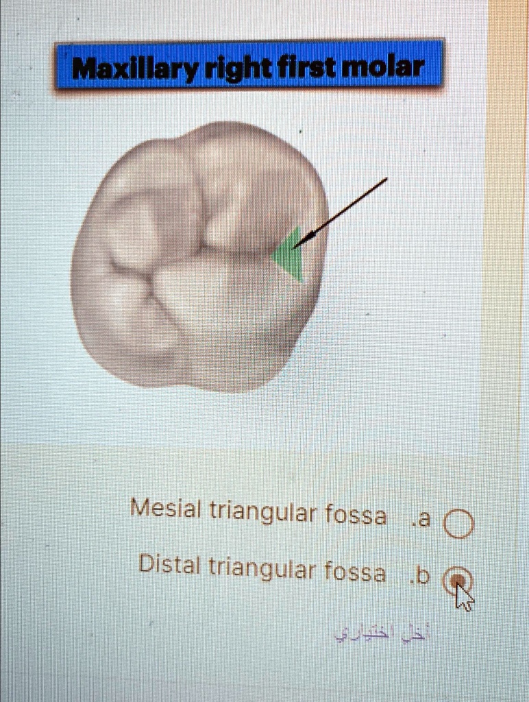 Maxillary right first molar Mesial triangular fossa Distal triangular ...