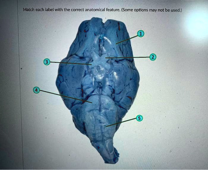 Match each label with the correct anatomical feature. (Some options may not be used.)