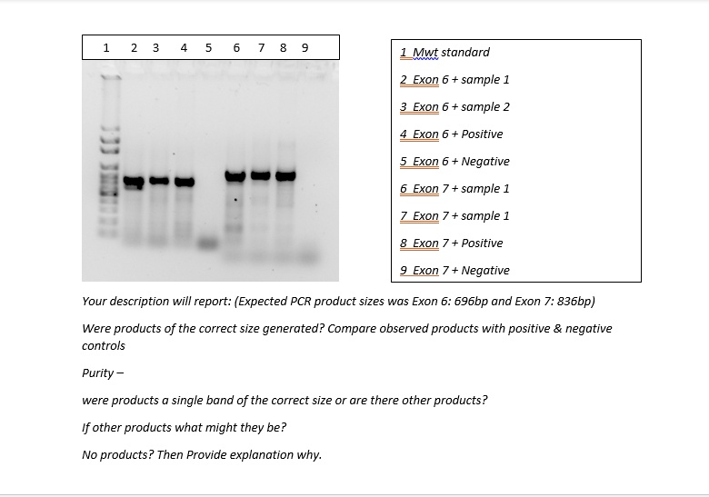 1 2 3 4 5 6 7 8 9

1 Mwt standard
2 Exon 6 + sample 1
3 Exon 6 + sample 2
4 Exon 6 + Positive
5 Exon 6 + Negative
6 Exon 7 + sample 1
7 Exon 7 + sample 1
8 Exon 7 + Positive
9 Exon 7 + Negative

Your description will report: (Expected PCR product sizes was Exon 6: 696bp and Exon 7: 836bp)

Were products of the correct size generated? Compare observed products with positive     negative controls

Purity –

were products a single band of the correct size or are there other products?

If other products what might they be?

No products? Then Provide explanation why.