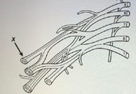 a 19 year old man is brought to the emergency department 20 minutes after he sustained a stab wound to the right upper arm during a bar fight physical examination shows a 2 cm stab wound over the ante