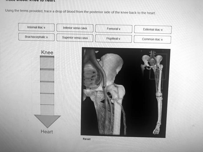 Using the terms provided, trace a drop of blood from the posterior side ...