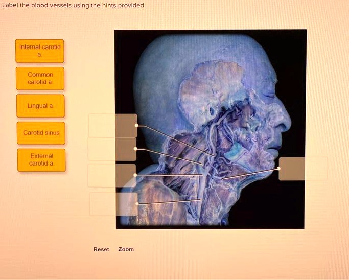 SOLVED: Label the blood vessels using the hints provided: Internal