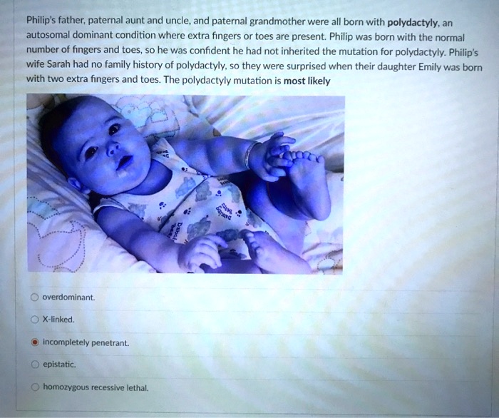 Philip's father, paternal aunt and uncle, and paternal grandmother were all born with polydactyly, an autosomal dominant condition where extra fingers or toes are present. Philip was born with the normal number of fingers and toes, so he was confident he had not inherited the mutation for polydactyly. Philip's wife Sarah had no family history of polydactyly, so they were surprised when their daughter Emily was born with two extra fingers and toes. The polydactyly mutation is most likely

overdominant.
X-linked.
incompletely penetrant.
epistatic.
homozygous recessive lethal.