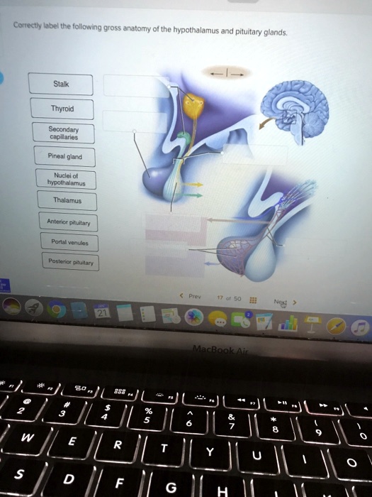 Solved Correctly Label The Following Gross Anatomy Of The Hypothalamus And Pituitary Glands