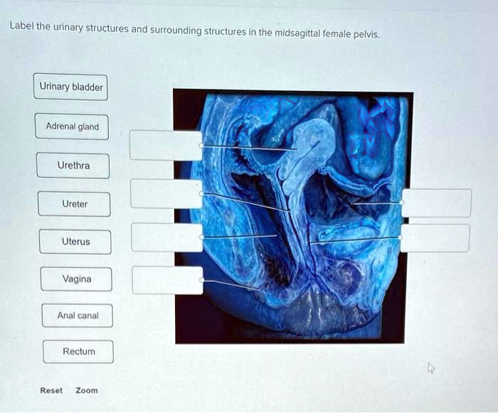 SOLVED Label The Urinary Structures And Surrounding Structures In The SOLVED Label The Urinary Structures And Surrounding Structures In The