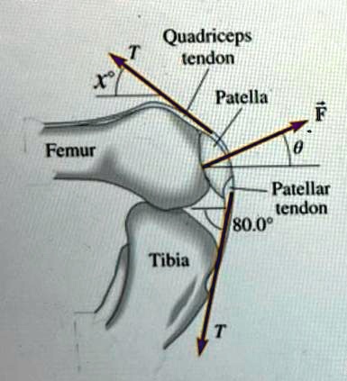 Solved: The Figure Shows The Quadriceps And The Patellar Tendons 