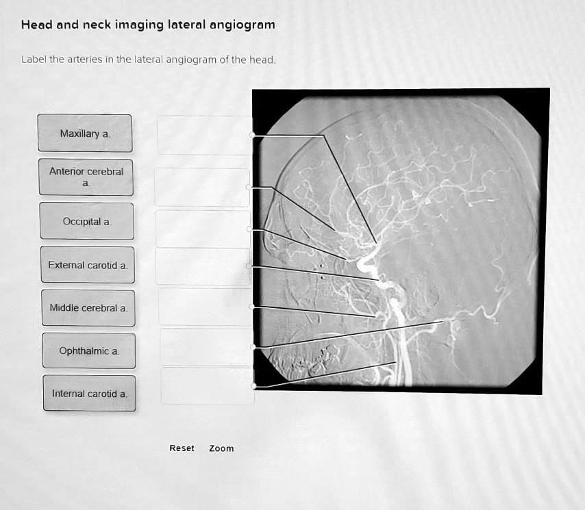 SOLVED: Head and neck imaging: Lateral angiogram Label the arteries in ...