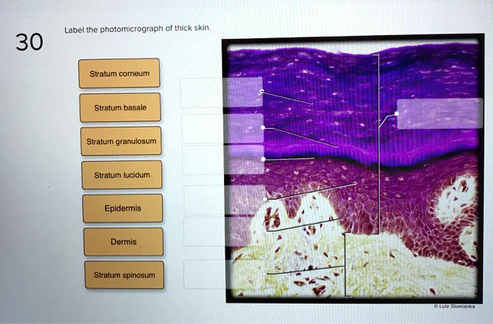 SOLVED: Label The Photomicrograph Of Thick Skin. 30 Stratum Corneum ...