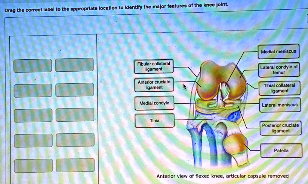 SOLVED: Anterior view of flexed knee, articular capsule removed Medial ...