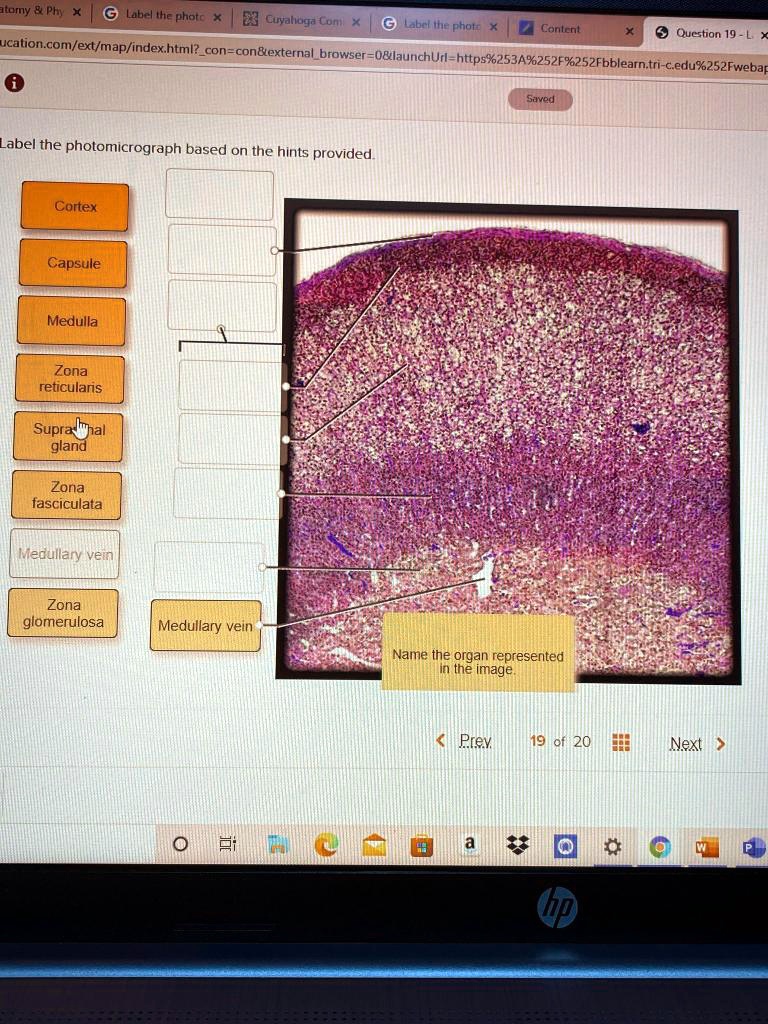 Label the photomicrograph based on the hints provided. Anatomy