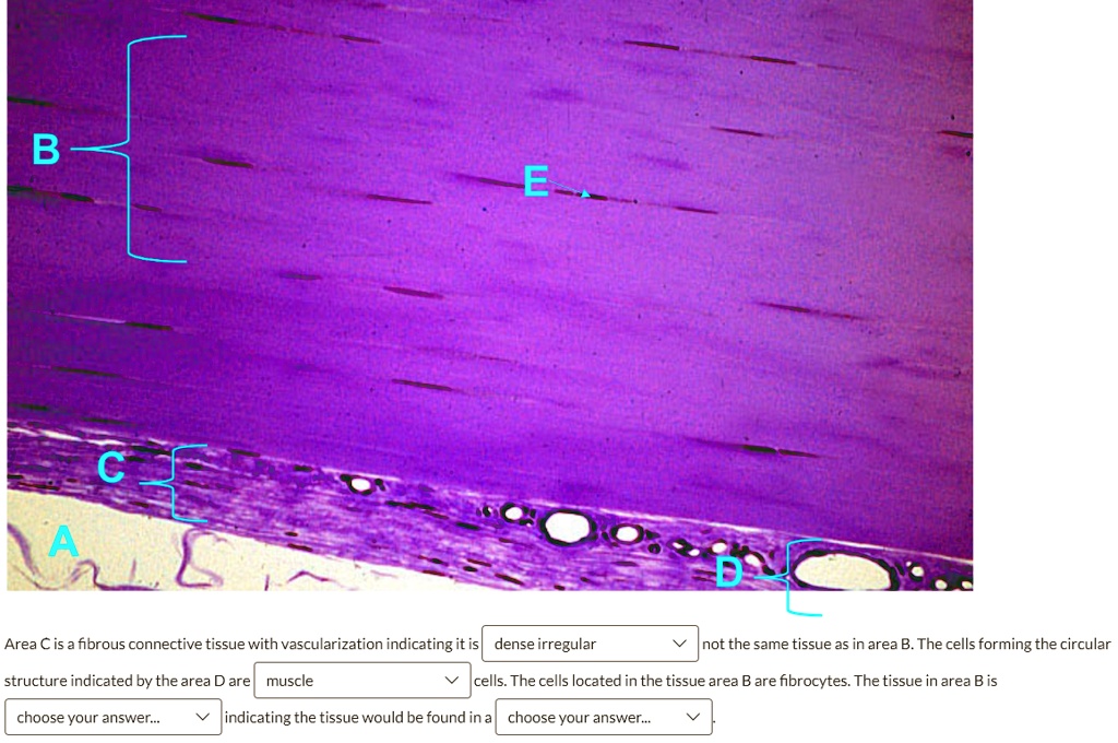 SOLVED: Blank 1: dense irregular, hyaline cartilage, adipose, epidermis ...