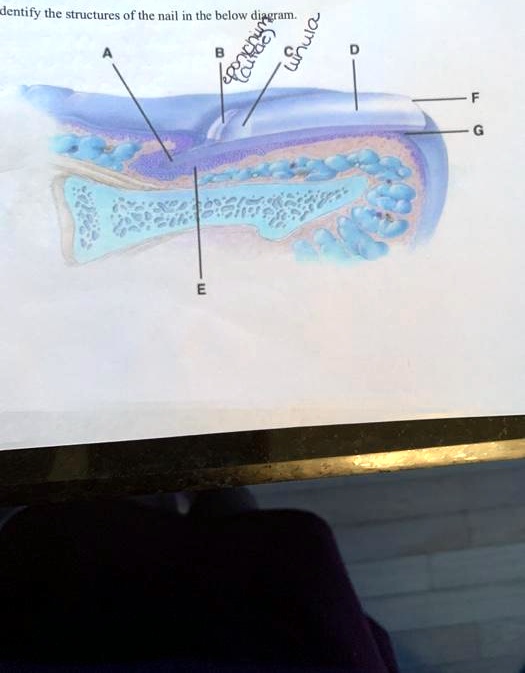 Identify the structures of the nail in the below diagram.
A
B
E
D
F
G