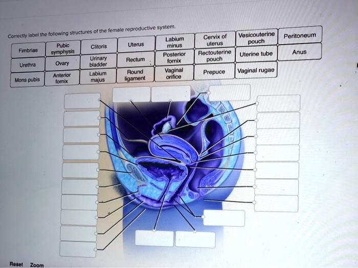 SOLVED: Correctly label the following structures of the female