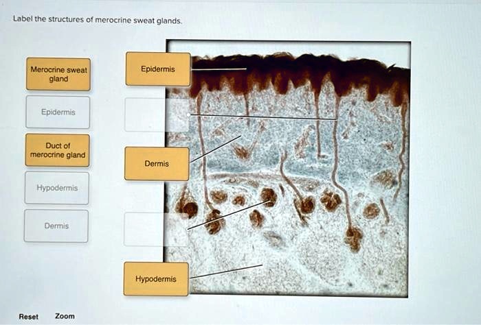 SOLVED: Label the structures of merocrine sweat glands. Merocrine sweat ...