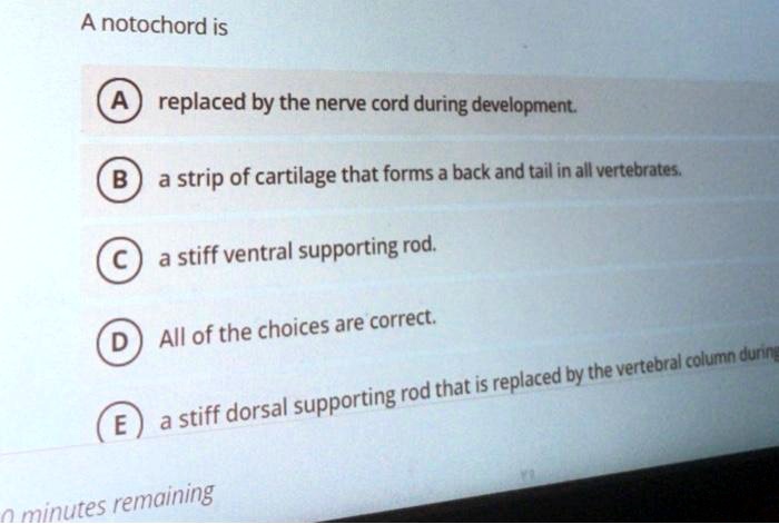 A notochord is
A replaced by the nerve cord during development.
B a strip of cartilage that forms a back and tail in all vertebrates.
C a stiff ventral supporting rod.
D All of the choices are correct.
E a stiff dorsal supporting rod that is replaced by the vertebral column during
