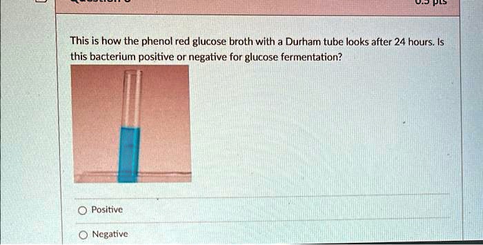 ujpls this is how the phenol red glucose broth with a durham tube looks ...