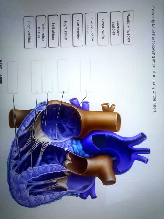 SOLVED Right ventricular trabeculae Left atrium Right atrium Left