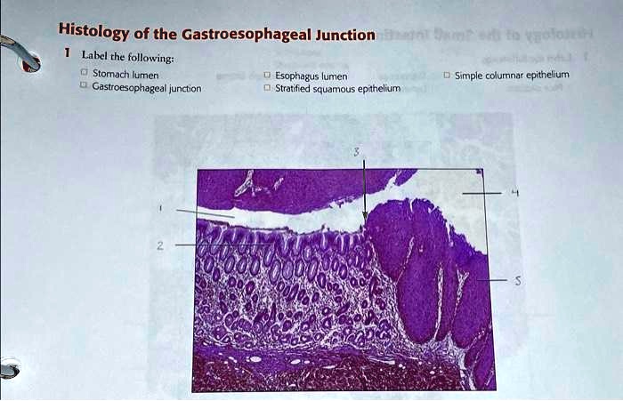 SOLVED: 1. Label the following: - Stomach lumen - Gastroesophageal ...