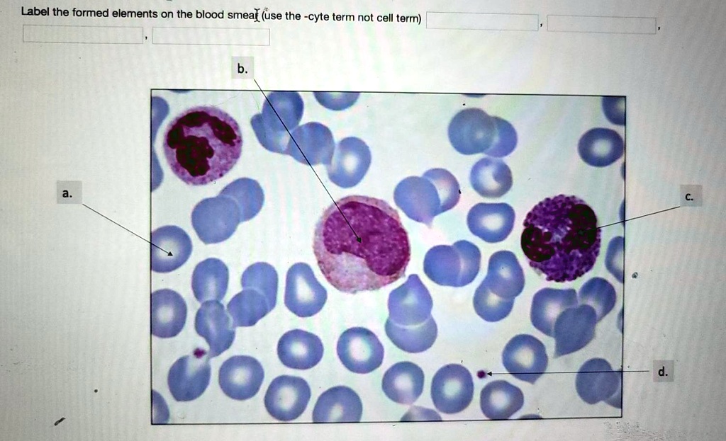 SOLVED: Label the formed elements on the blood smear (use the -cyte ...