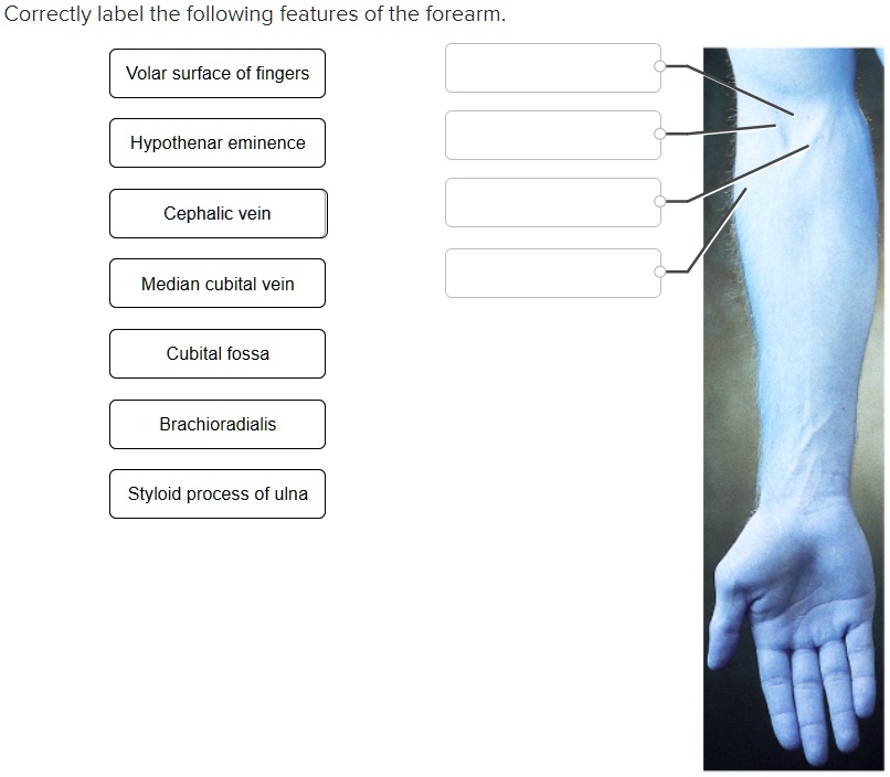 SOLVED Correctly label the following features of the forearm Volar