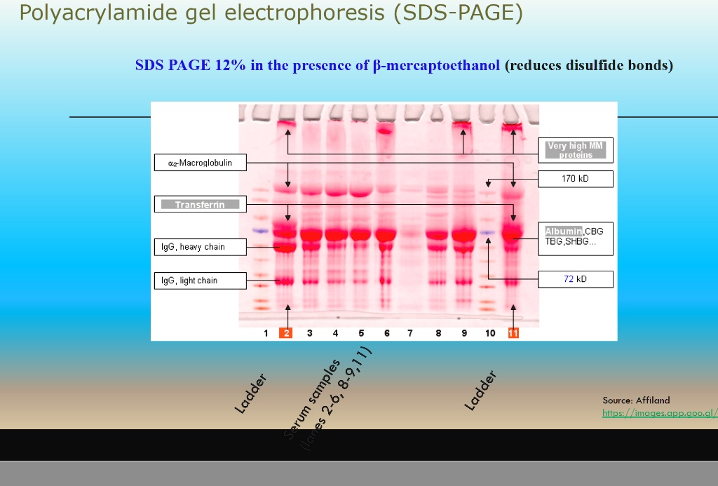 Polyacrylamide Gel Electrophoresis (SDS-PAGE)SDS PAGE… - SolvedLib