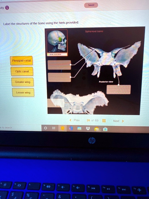 SOLVED Label the structures of the bone using the hints provided