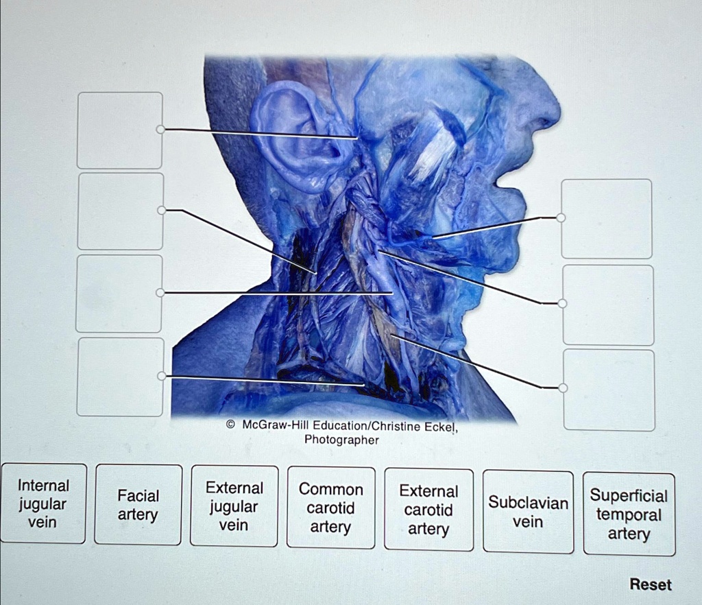 Internal jugular vein Facial artery External jugular vein Common ...