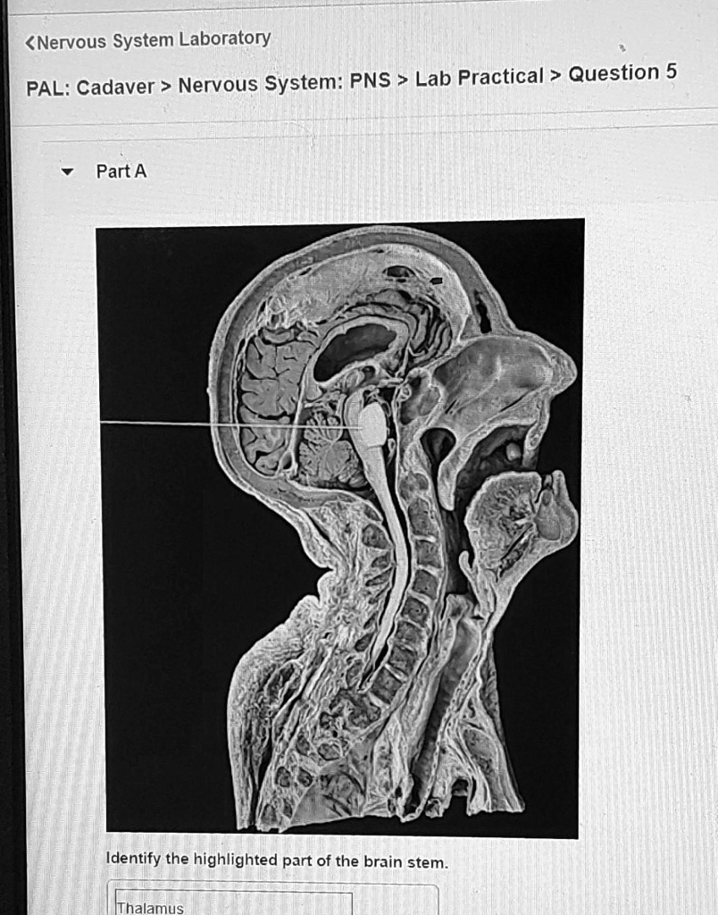 Nervous System Laboratory: Pal Cadaver > Nervous System Pns > Lab 