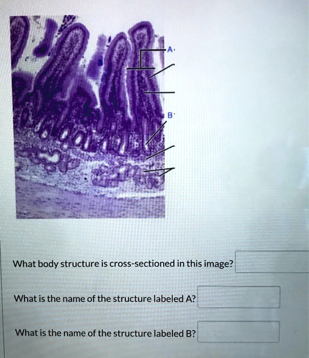 SOLVED What body structure is crosssectioned in this image? What is