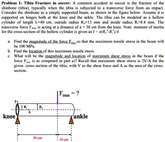 SOLVED: Problem 1: Tibia Fracture in Soccer: A common accident in ...