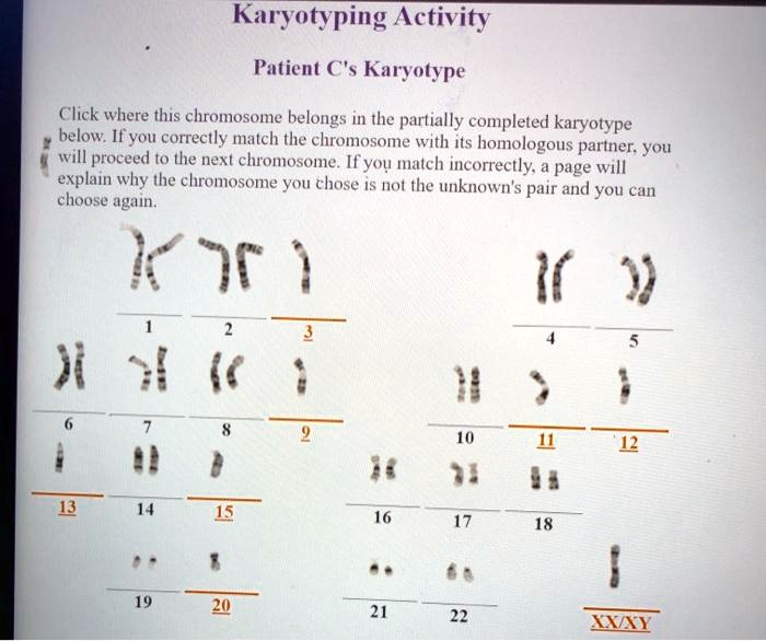 Solved Karyotyping Activity Patient Cs Karyotype Click Where This Chromosome Belongs In The 7029