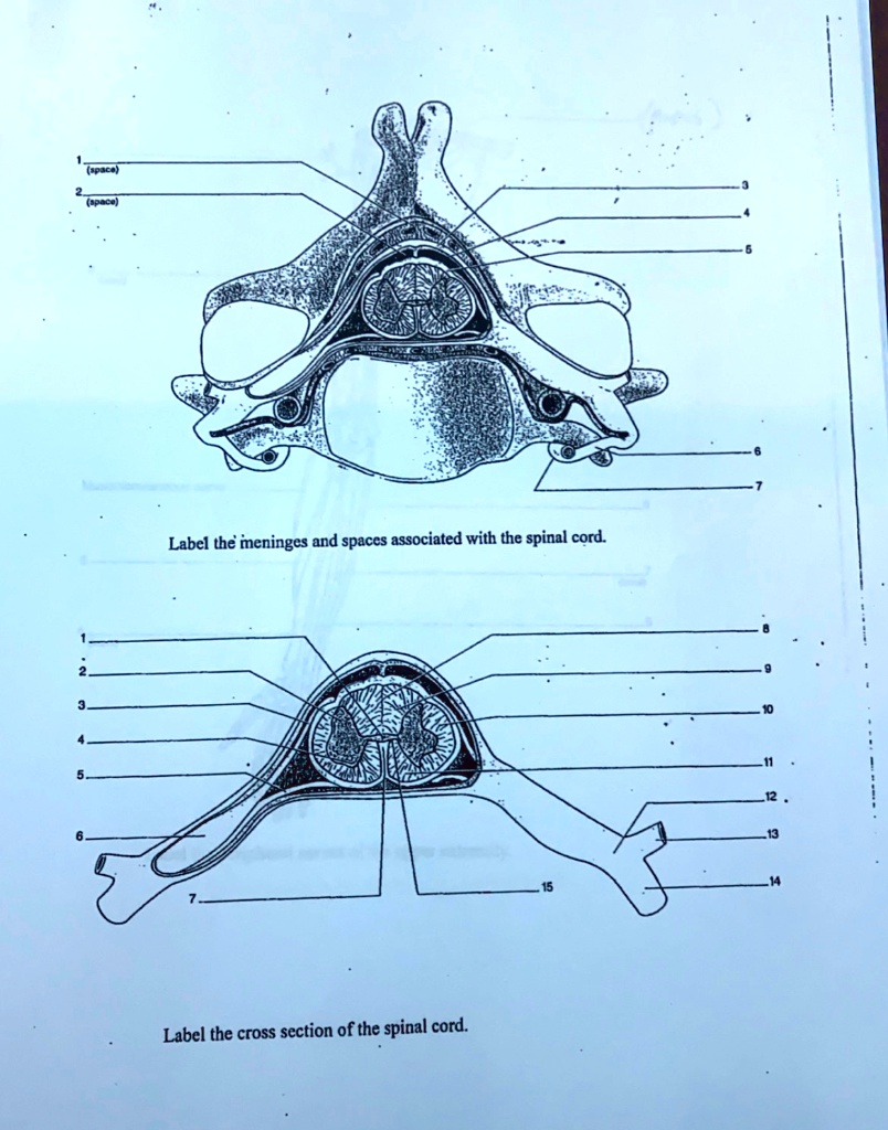 SOLVED: Label the meninges and spaces associated with the spinal cord ...