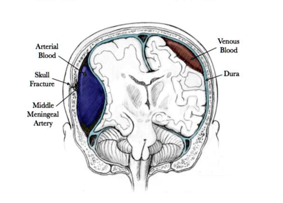 SOLVED: This mid-coronal slice through the human skull and brain shows