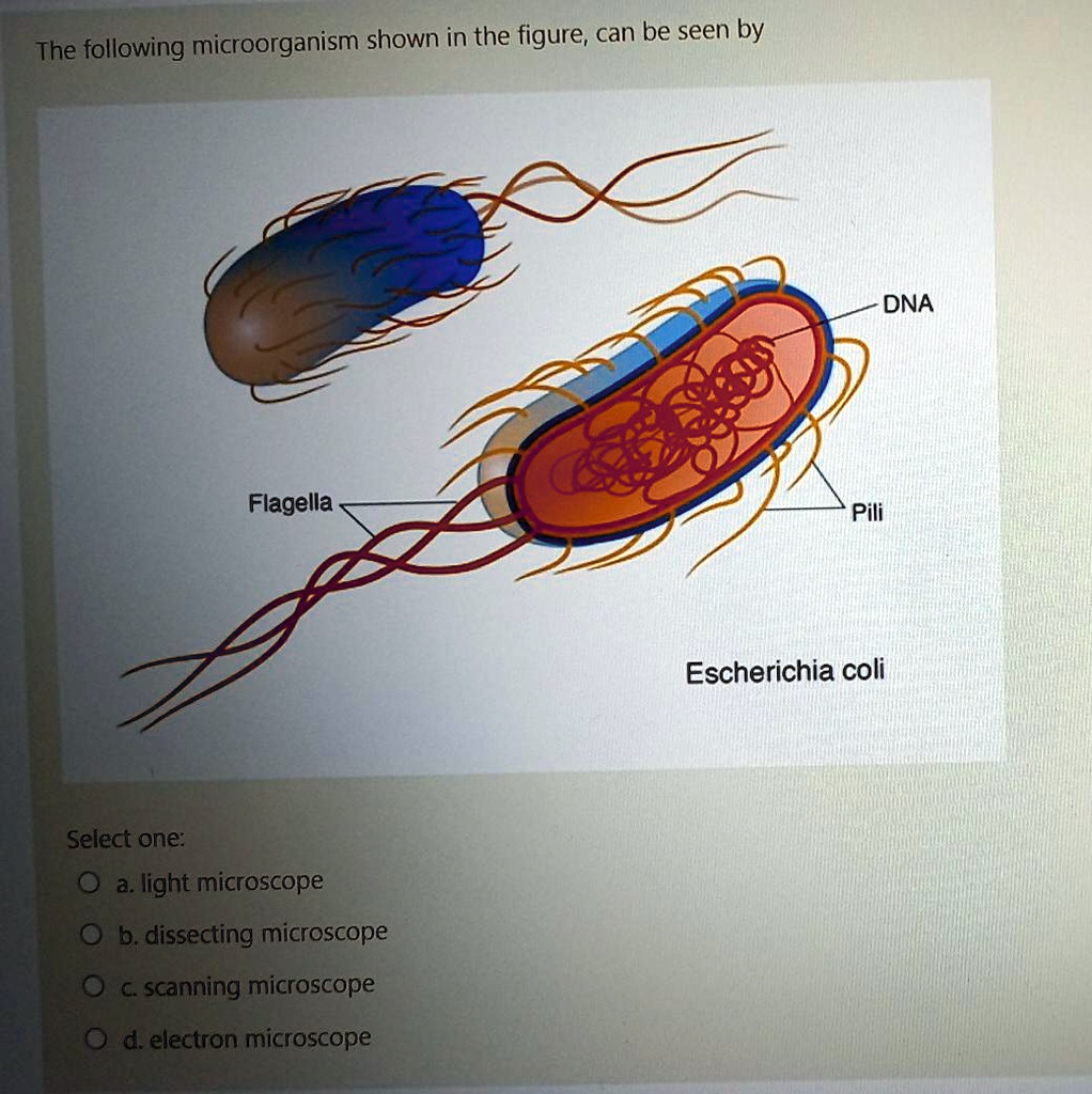 SOLVED The following shown in the figure; can be seen by DNA Flagella Pili
