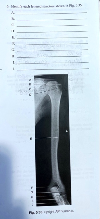 6. Identify each lettered structure shown in Fig. 5.35. A. B. C. D. E ...