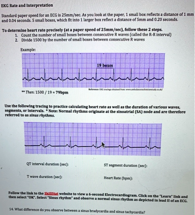 Solved Ekg Rate And Interpretation Standard Paper Speed For An Ecg Is 2smm Sec As You Look At The Paper Small Box Reflects A Distance Of 1 Mm And 0 04 Seconds Small Boxes