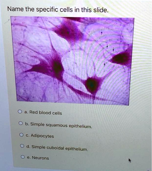 name the specific cells in this slide ared blood cells simple squamous ...
