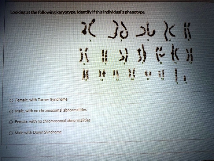 Looking at the following karyotype, identify if this individual's phenotype.
1 2 3 4 5
6 7 8 9 10 11 12
13 14 15 16 17 18 X Y
Female, with Turner Syndrome
Male, with no chromosomal abnormalities
Female, with no chromosomal abnormalities
Male with Down Syndrome